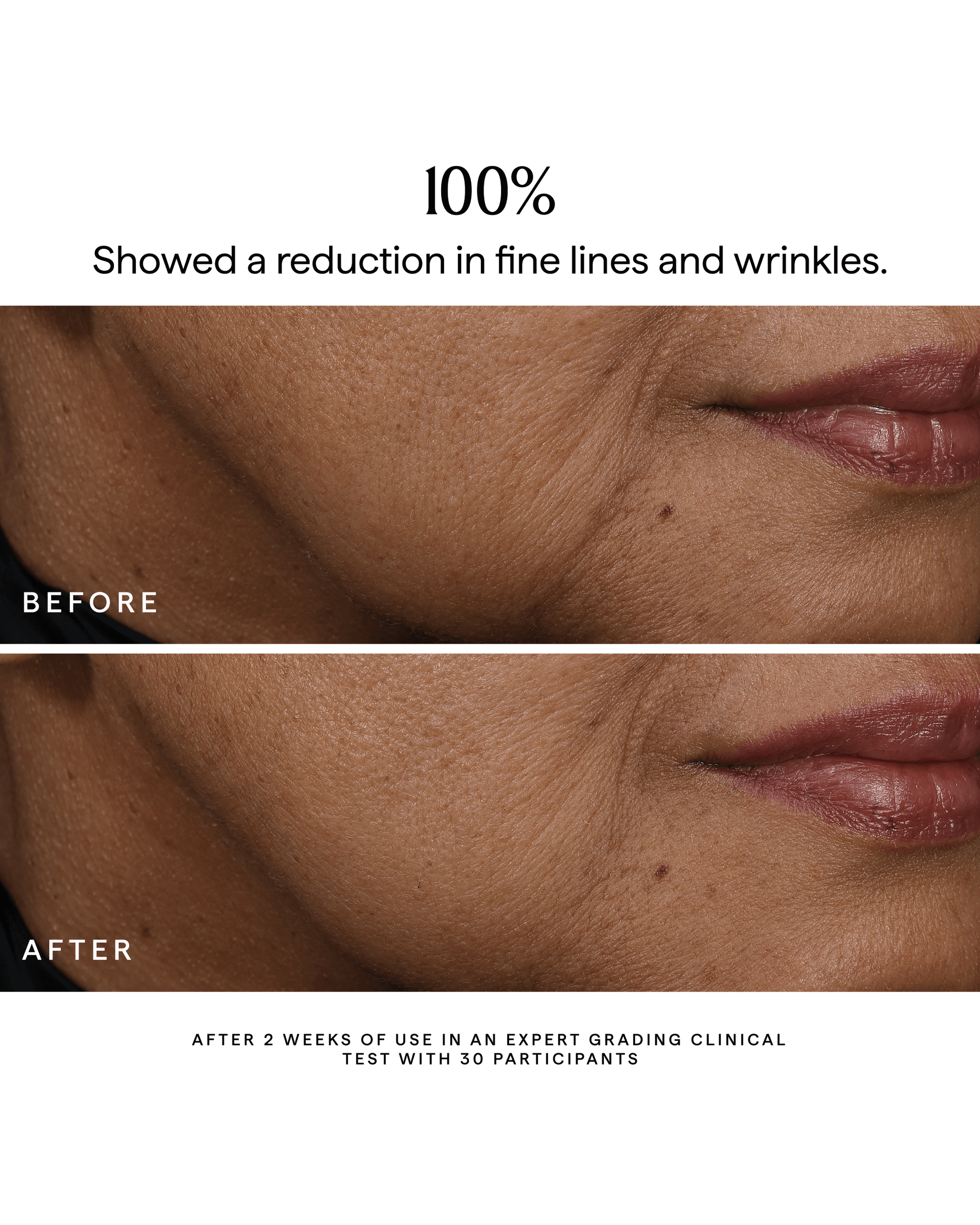 BAKUCHIOL Dual-Retinol Alternative Face Serum