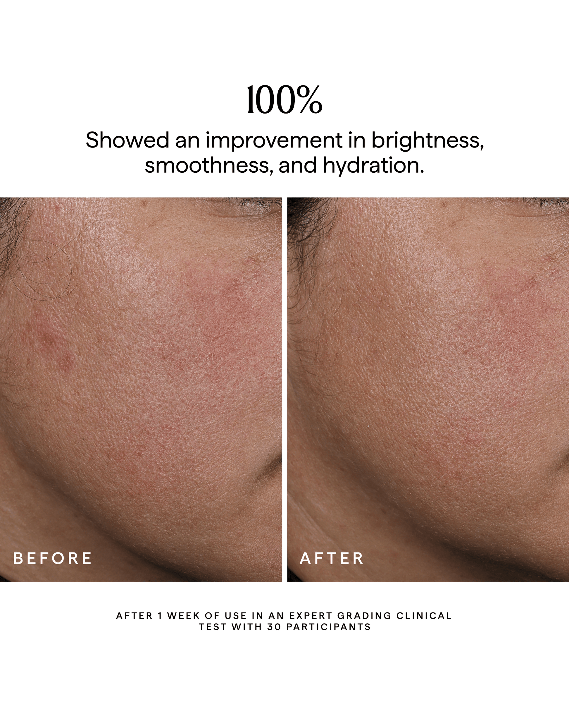 NOVA Turmeric + Niacinamide Bi-Phase Glow Facial Oil